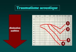 Schéma: Bruit et oreille