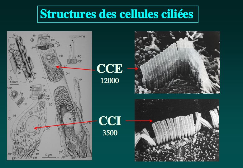 Bouchon de cire  Otologie - Dr Albert Mudry