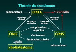 Schéma: Maladies de l’oreille