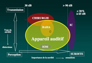 Schéma: Traitement général de la surdité