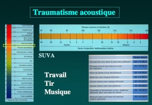 Schéma: Bruit et oreille